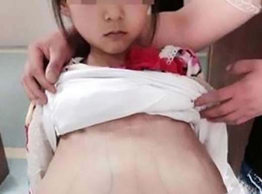 Pregnant